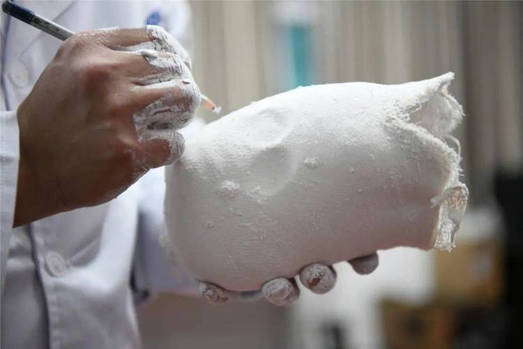 精准适配，助残前行——凯里市残联开展假肢与矫形器取型服务